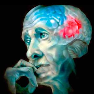 April 11 – World Day to Combat Parkinson’s Disease11 квітня – Всесвітній день боротьби з хворобою Паркінсона