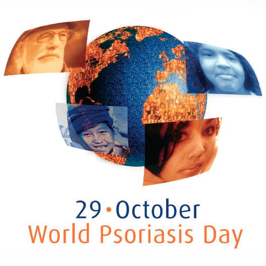 29 жовтня – Всесвітній день псоріазу29 жовтня – Всесвітній день псоріазу
